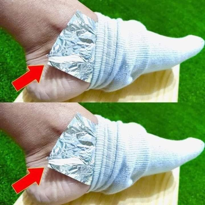 Uncover the Surprising Benefits of Wrapping Aluminum Foil on Your Feet: A Cost-Effective Remedy