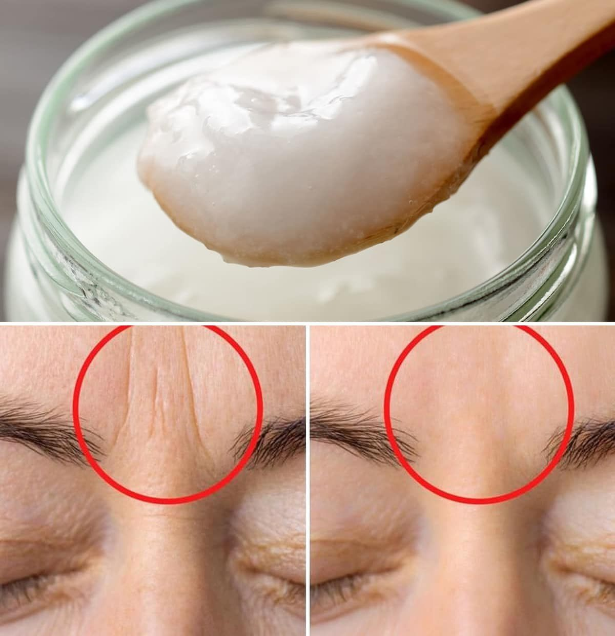 2 masks to eliminate wrinkles between the eyebrows